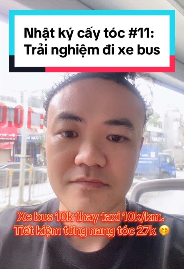 Ngày 11 sau cấy tóc: Đi xe bus thay taxi