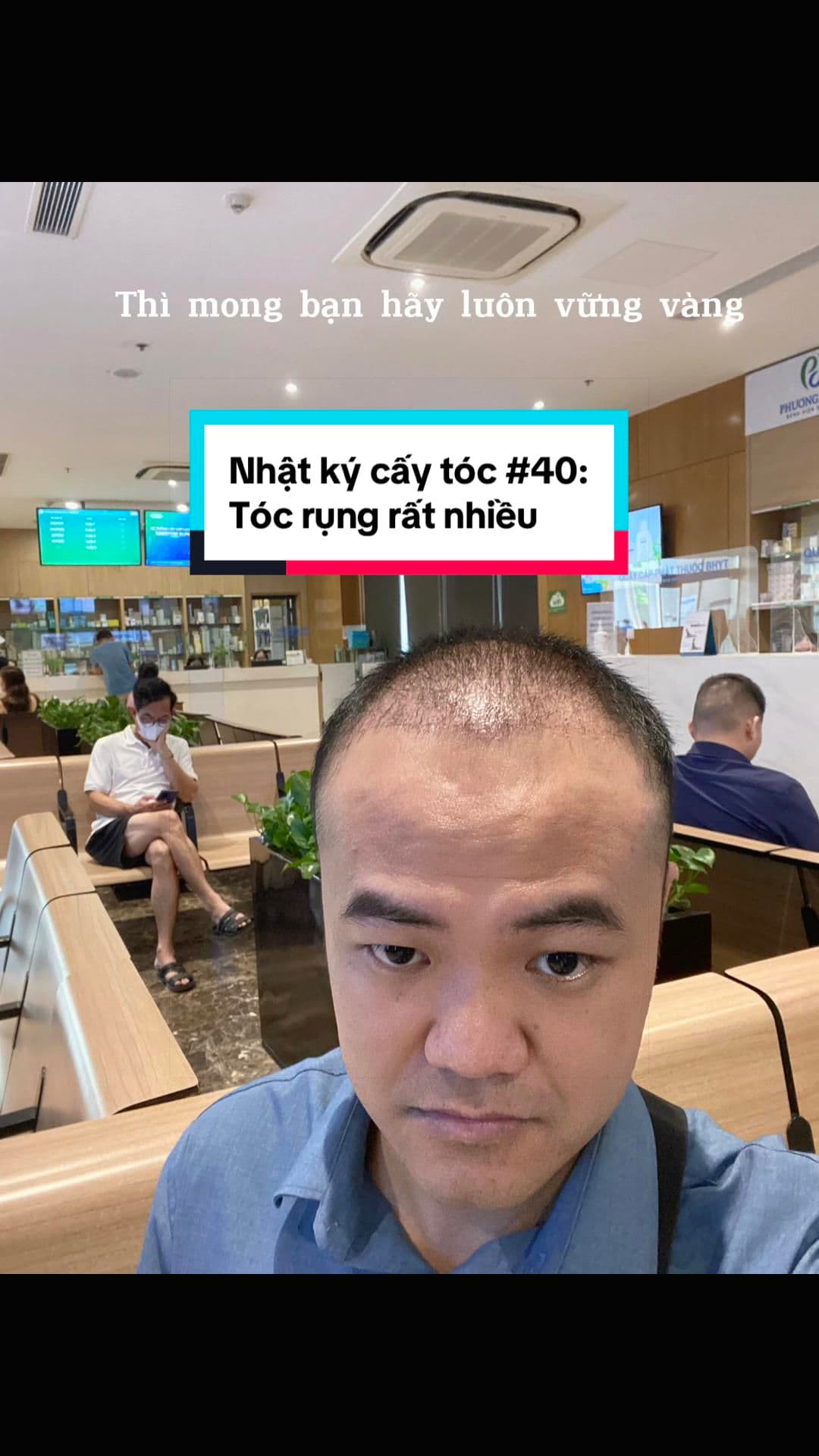 Tóc ngày 40 sau cấy tóc